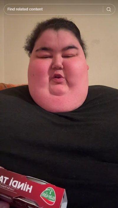 ดาว TikTok สายกินจุ ดับสลดวัย 24 พบอ้วนจนกระทบสุขภาพ ดาว TikTok สายกินจุ ดับสลดวัย 24 พบอ้วนจนกระทบสุขภาพ