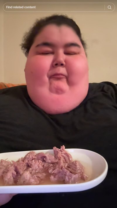 ดาว TikTok สายกินจุ ดับสลดวัย 24 พบอ้วนจนกระทบสุขภาพ ดาว TikTok สายกินจุ ดับสลดวัย 24 พบอ้วนจนกระทบสุขภาพ