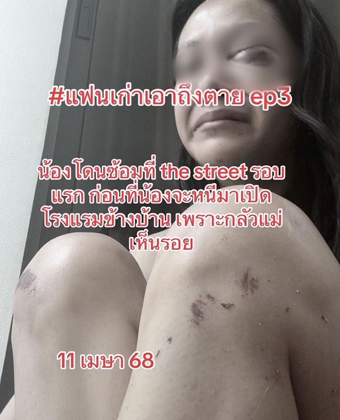 ทนายฟาดลูกตำรวจ ซ้อมนางเอกเอ็มวี จนแทบไม่รอด ทนายฟาดลูกตำรวจ ซ้อมนางเอกเอ็มวี จนแทบไม่รอด
